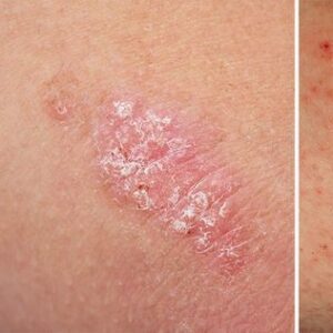 5 Common Skin Issues And How To Treat Them Naturally – G-BODY