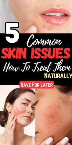 5 Common Skin Issues And How To Treat Them Naturally