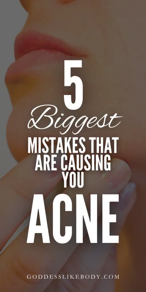 5 Biggest Skincare Mistakes That Are Causing You Acne